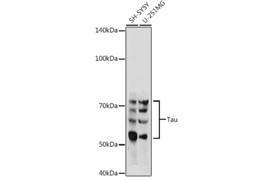 Western Blot - Anti-Tau Antibody (A17182) - Antibodies.com
