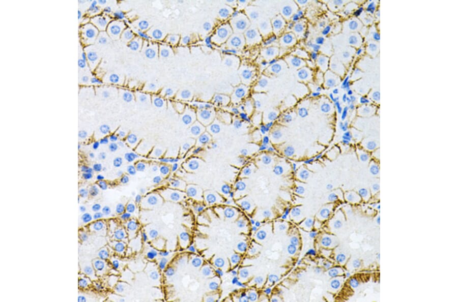 Immunohistochemistry - Anti-Tau Antibody (A17182) - Antibodies.com