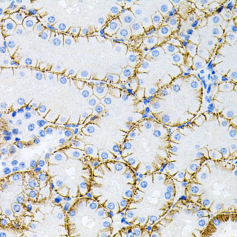 Immunohistochemistry - Anti-Tau Antibody (A17182) - Antibodies.com