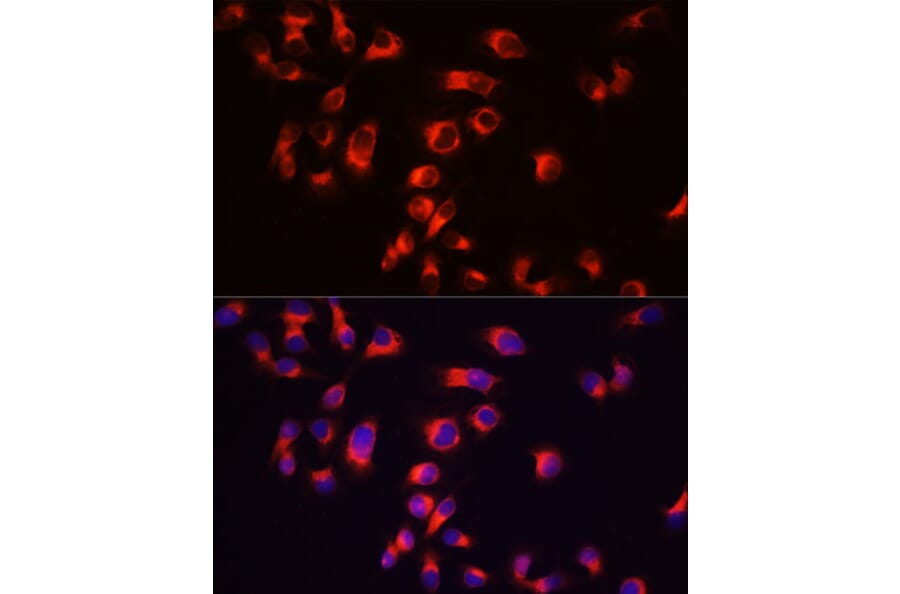 Immunofluorescence - Anti-Tau Antibody (A17182) - Antibodies.com