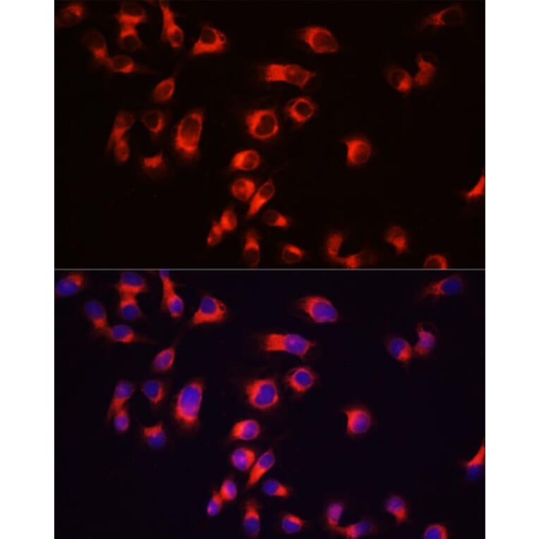 Immunofluorescence - Anti-Tau Antibody (A17182) - Antibodies.com