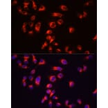 Immunofluorescence - Anti-Tau Antibody (A17182) - Antibodies.com