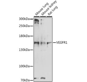 Western Blot - Anti-VEGF Receptor 1 Antibody (A17185) - Antibodies.com