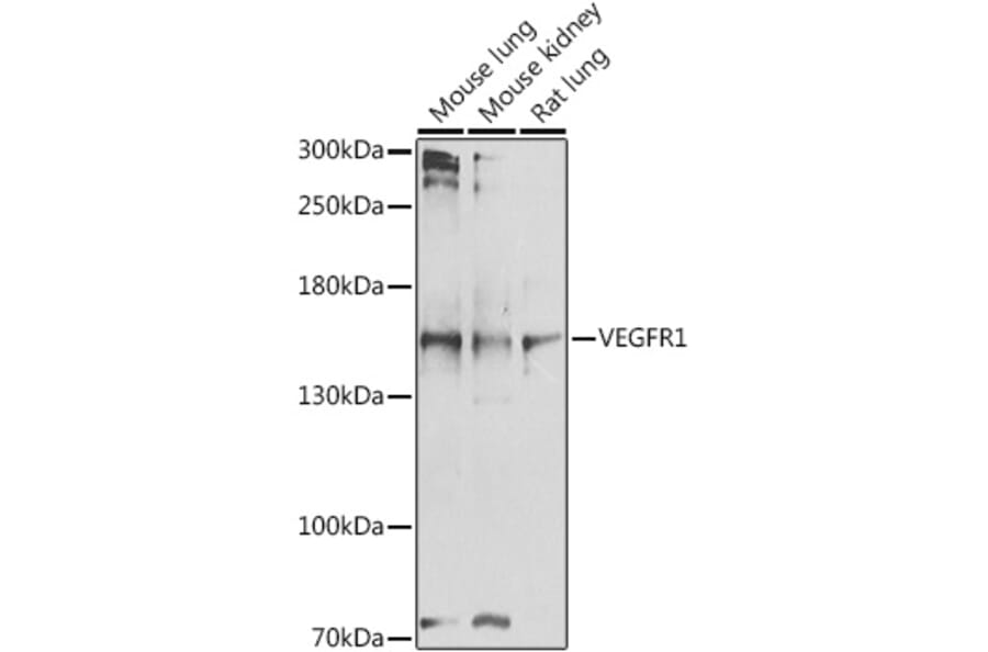 Western Blot - Anti-VEGF Receptor 1 Antibody (A17185) - Antibodies.com
