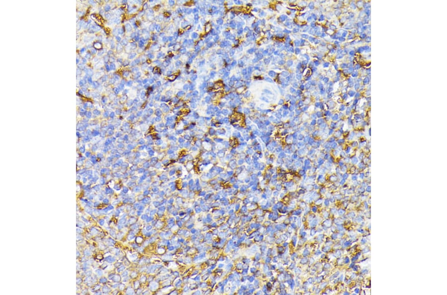Immunohistochemistry - Anti-VEGF Receptor 1 Antibody (A17185) - Antibodies.com