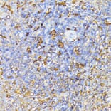 Immunohistochemistry - Anti-VEGF Receptor 1 Antibody (A17185) - Antibodies.com