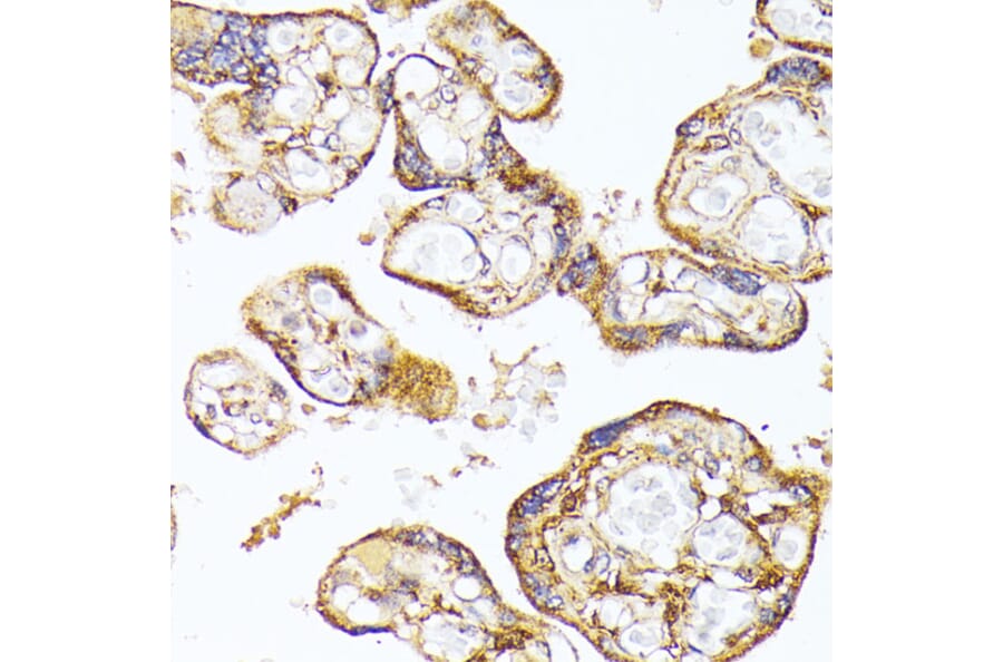 Immunohistochemistry - Anti-VEGF Receptor 1 Antibody (A17185) - Antibodies.com