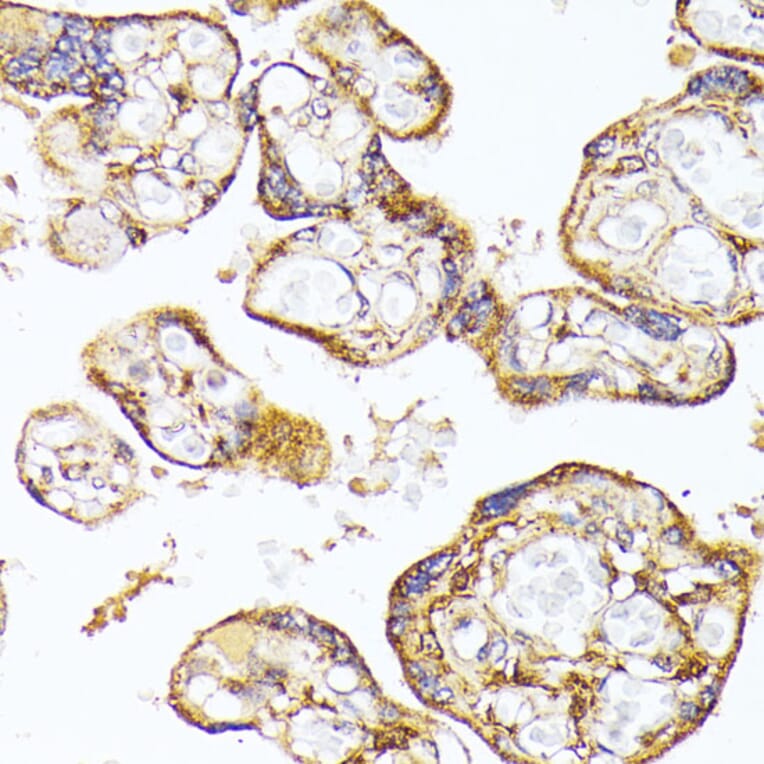 Immunohistochemistry - Anti-VEGF Receptor 1 Antibody (A17185) - Antibodies.com