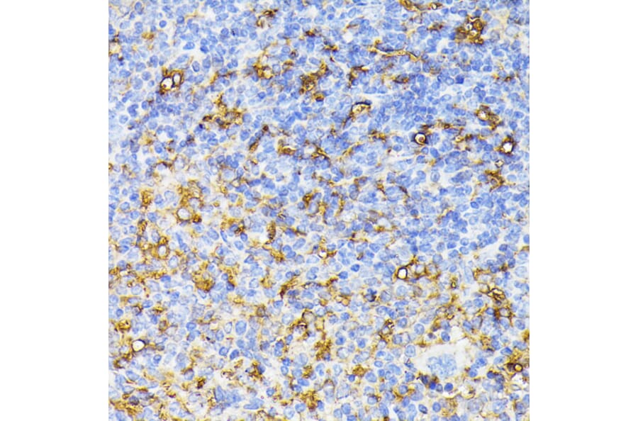 Anti-VEGF Receptor 1 Antibody (A17185) - IHC