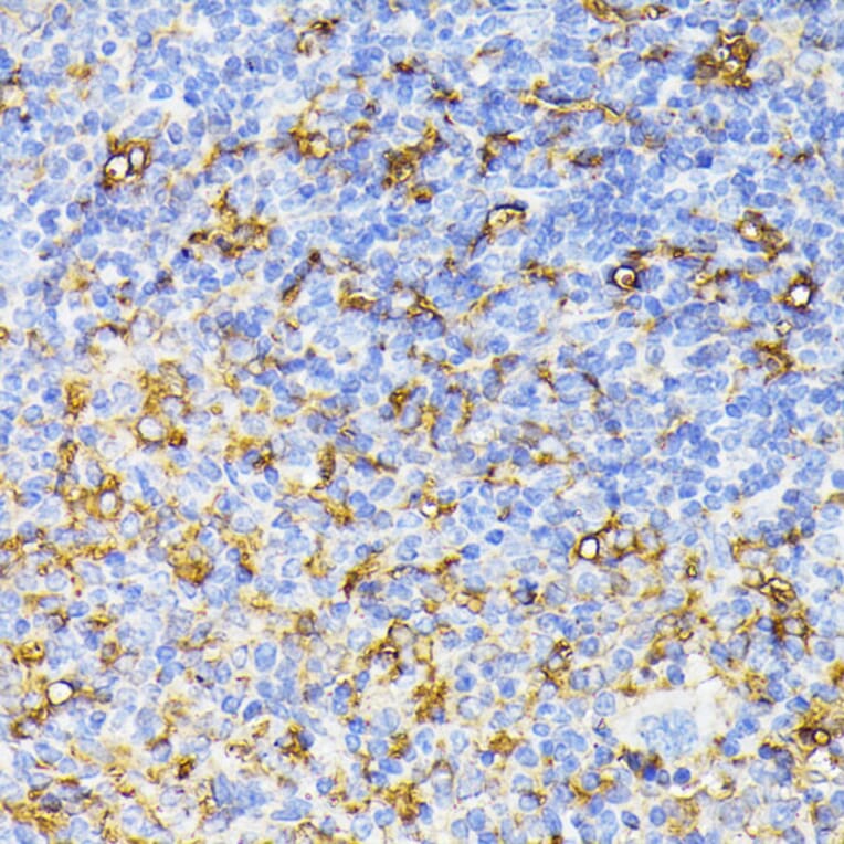Immunohistochemistry - Anti-VEGF Receptor 1 Antibody (A17185) - Antibodies.com