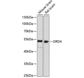 Western Blot - Anti-DRD4 Antibody (A17186) - Antibodies.com