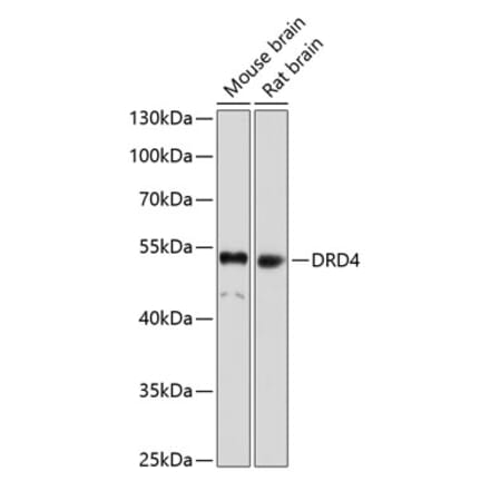 Western Blot - Anti-DRD4 Antibody (A17186) - Antibodies.com