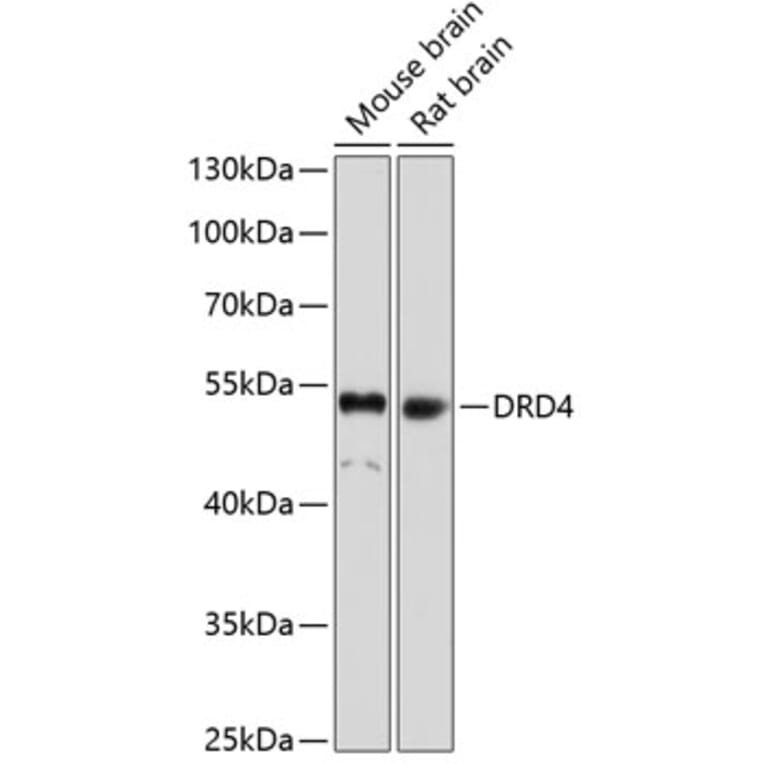 Western Blot - Anti-DRD4 Antibody (A17186) - Antibodies.com