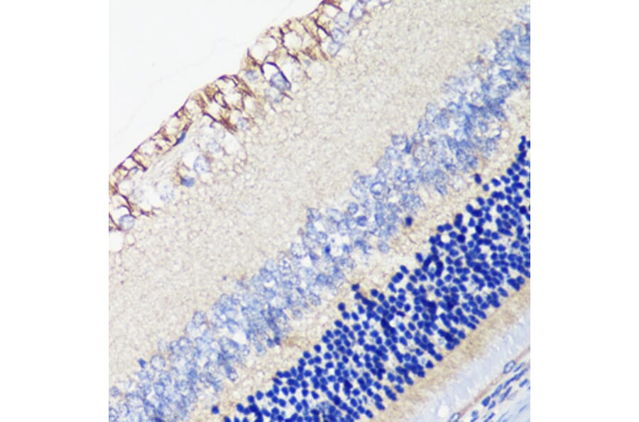 Immunohistochemistry - Anti-DRD4 Antibody (A17186) - Antibodies.com