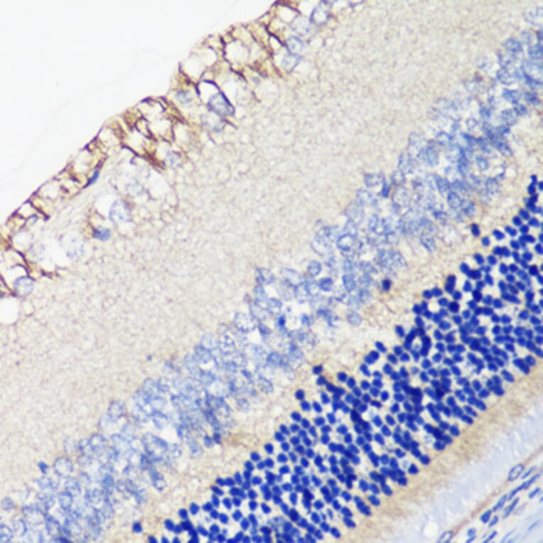 Immunohistochemistry - Anti-DRD4 Antibody (A17186) - Antibodies.com