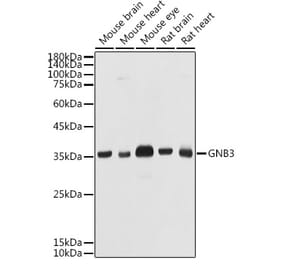 Western Blot - Anti-GNB3 Antibody (A17187) - Antibodies.com