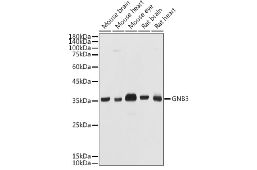 Western Blot - Anti-GNB3 Antibody (A17187) - Antibodies.com