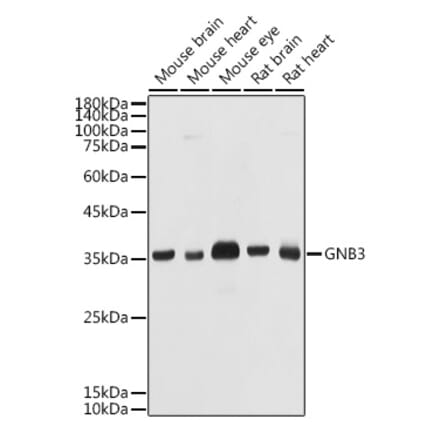 Western Blot - Anti-GNB3 Antibody (A17187) - Antibodies.com