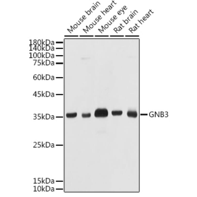 Western Blot - Anti-GNB3 Antibody (A17187) - Antibodies.com