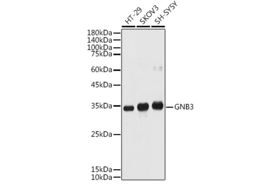 Western Blot - Anti-GNB3 Antibody (A17187) - Antibodies.com