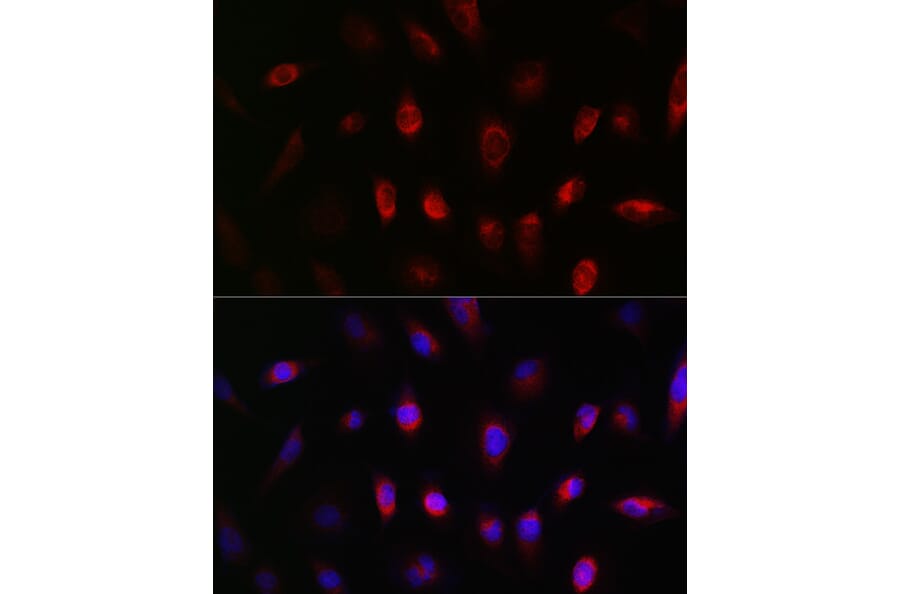 Immunofluorescence - Anti-GNB3 Antibody (A17187) - Antibodies.com