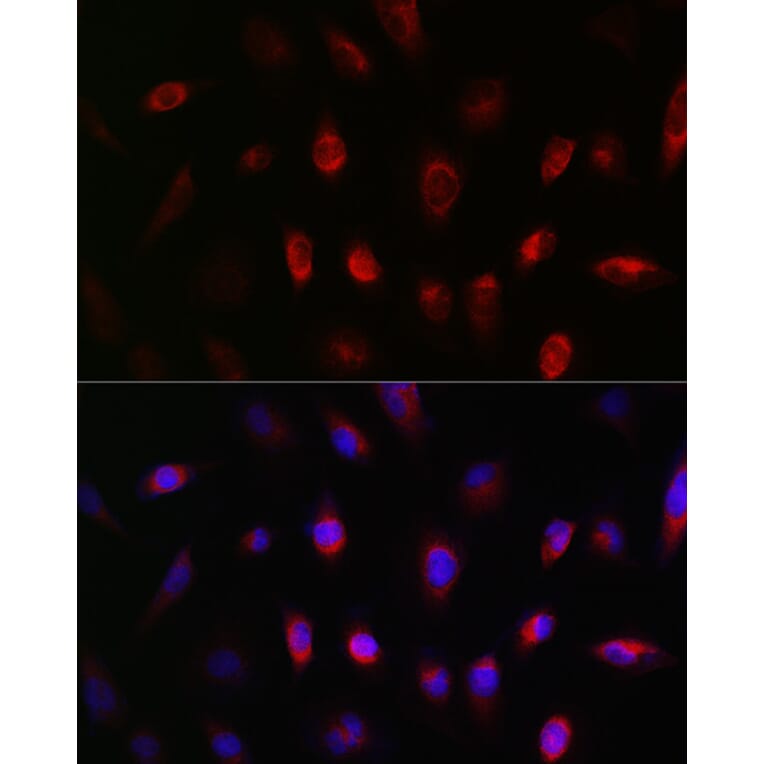 Immunofluorescence - Anti-GNB3 Antibody (A17187) - Antibodies.com