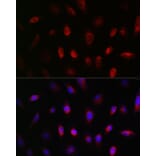 Immunofluorescence - Anti-GNB3 Antibody (A17187) - Antibodies.com