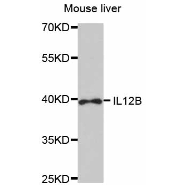 Western Blot - Anti-IL12B Antibody (A1394) - Antibodies.com