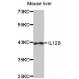 Western Blot - Anti-IL12B Antibody (A1394) - Antibodies.com