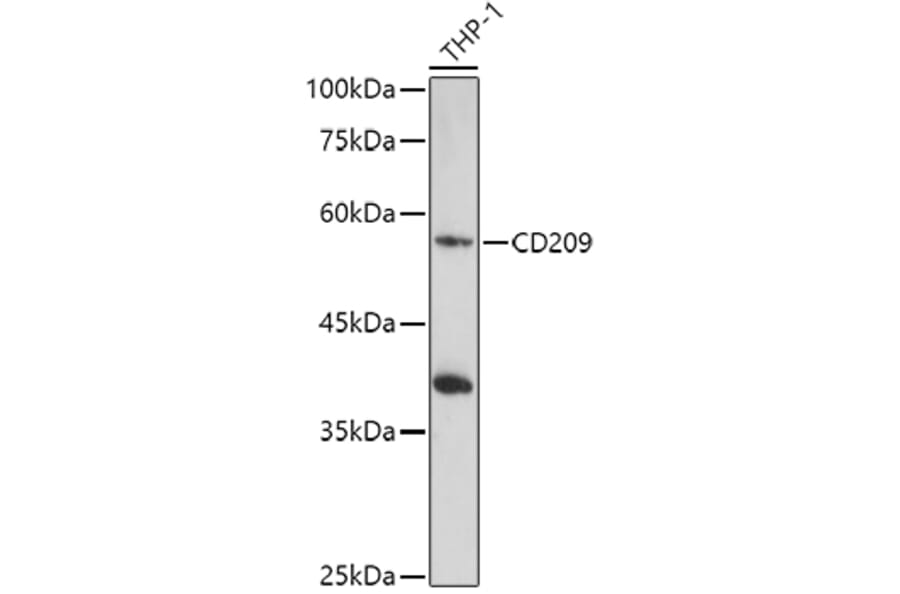 Western Blot - Anti-DC-SIGN Antibody (A17189) - Antibodies.com