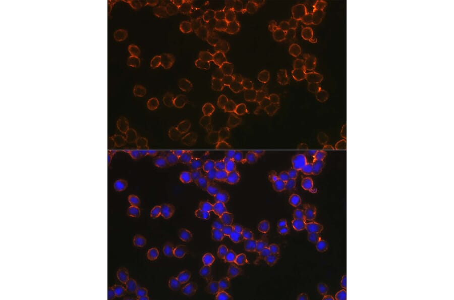 Immunofluorescence - Anti-DC-SIGN Antibody (A17189) - Antibodies.com