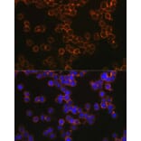 Immunofluorescence - Anti-DC-SIGN Antibody (A17189) - Antibodies.com