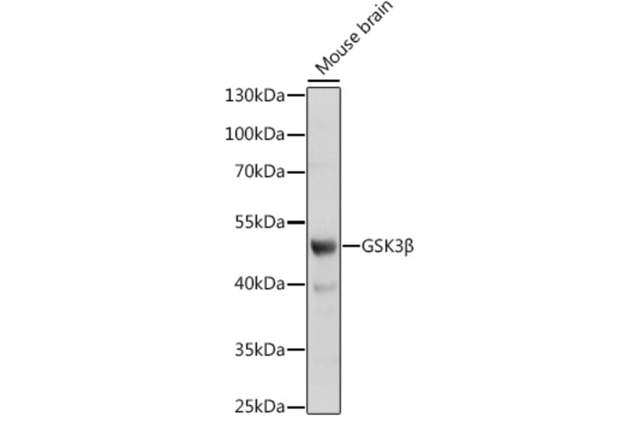 Western Blot - Anti-GSK3 beta Antibody (A17190) - Antibodies.com