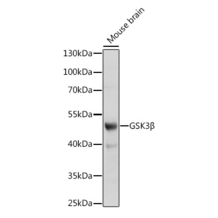 Western Blot - Anti-GSK3 beta Antibody (A17190) - Antibodies.com