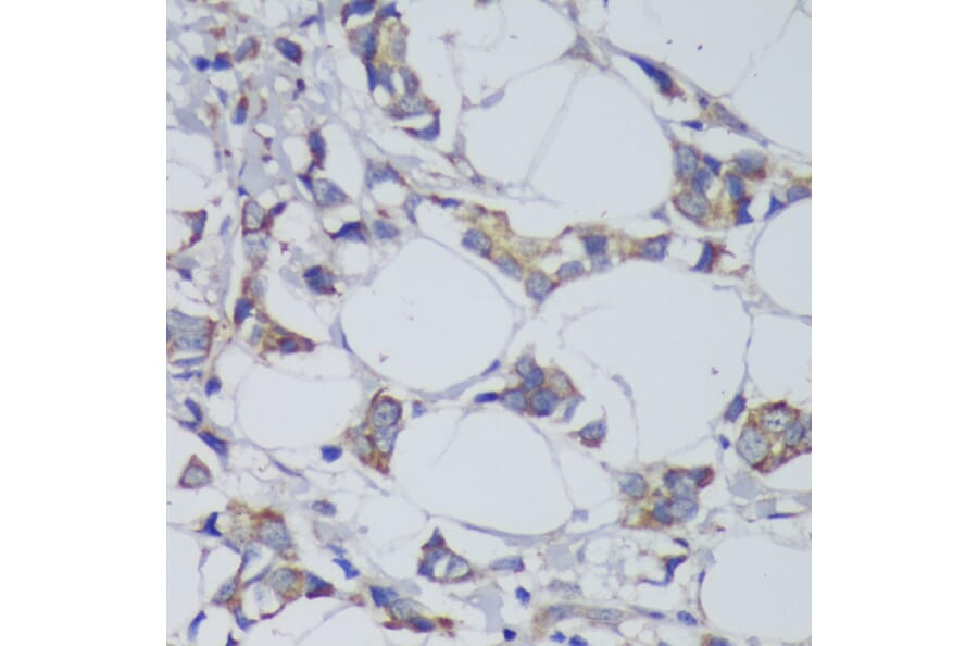 Immunohistochemistry - Anti-GSK3 beta Antibody (A17190) - Antibodies.com