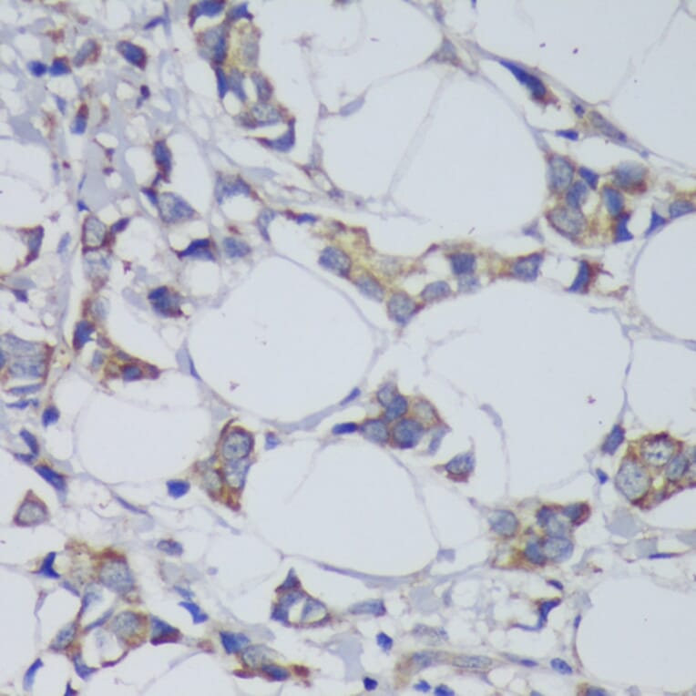 Immunohistochemistry - Anti-GSK3 beta Antibody (A17190) - Antibodies.com