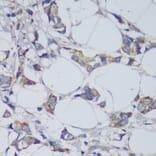 Immunohistochemistry - Anti-GSK3 beta Antibody (A17190) - Antibodies.com