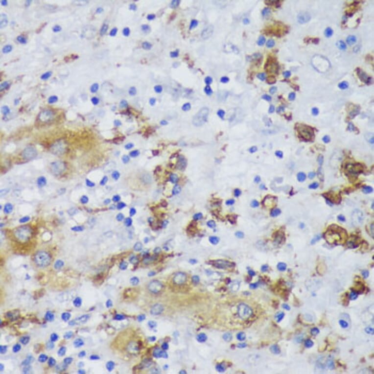 Immunohistochemistry - Anti-GSK3 beta Antibody (A17190) - Antibodies.com