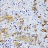 Immunohistochemistry - Anti-GSK3 beta Antibody (A17190) - Antibodies.com
