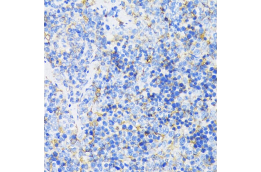 Immunohistochemistry - Anti-GSK3 beta Antibody (A17190) - Antibodies.com