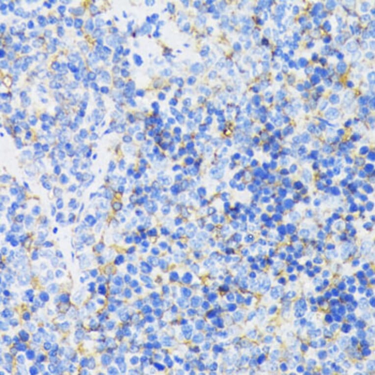 Immunohistochemistry - Anti-GSK3 beta Antibody (A17190) - Antibodies.com