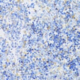 Immunohistochemistry - Anti-GSK3 beta Antibody (A17190) - Antibodies.com