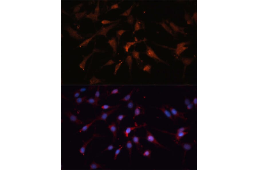 Immunofluorescence - Anti-GSK3 beta Antibody (A17190) - Antibodies.com
