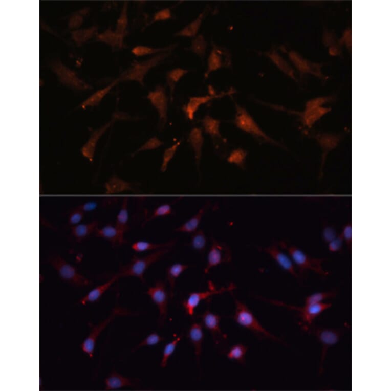 Immunofluorescence - Anti-GSK3 beta Antibody (A17190) - Antibodies.com