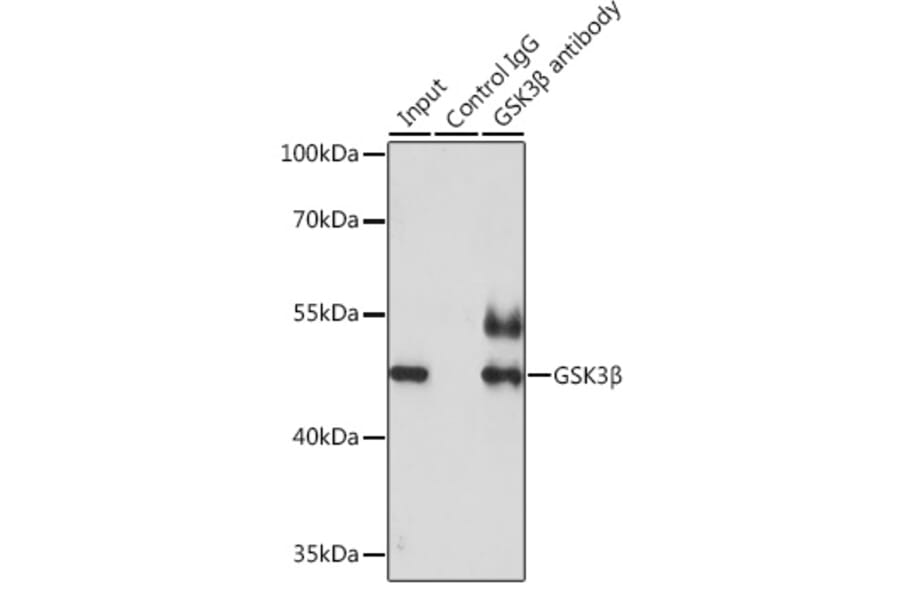Western Blot - Anti-GSK3 beta Antibody (A17190) - Antibodies.com