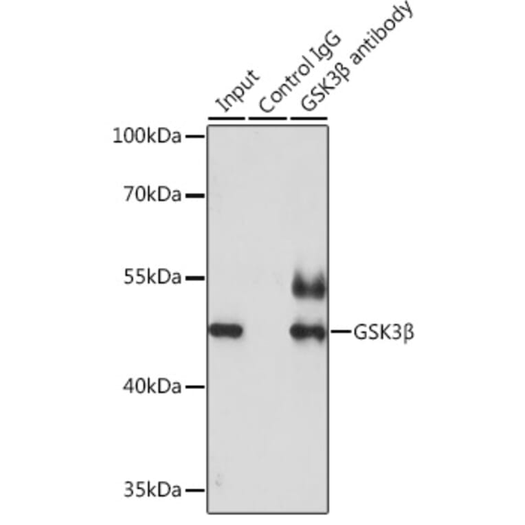 Western Blot - Anti-GSK3 beta Antibody (A17190) - Antibodies.com