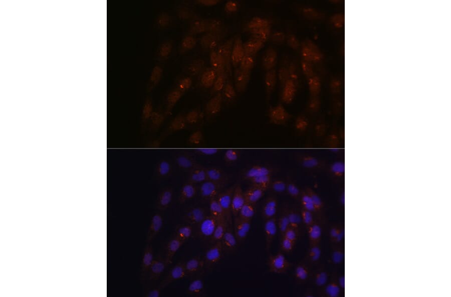 Immunofluorescence - Anti-CUX1 Antibody (A17192) - Antibodies.com