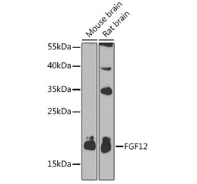 Western Blot - Anti-FGF12 Antibody (A17193) - Antibodies.com