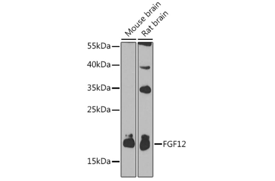 Western Blot - Anti-FGF12 Antibody (A17193) - Antibodies.com