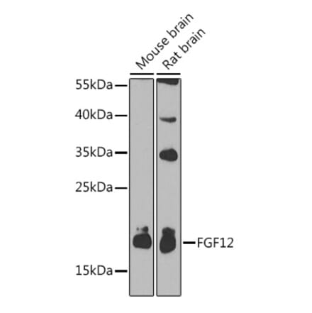 Western Blot - Anti-FGF12 Antibody (A17193) - Antibodies.com